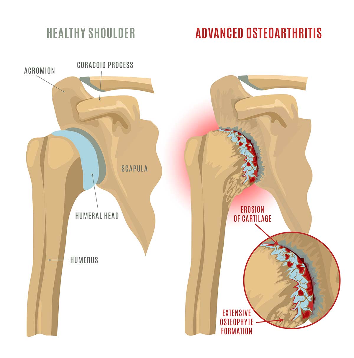 Shoulder anatomy illustration